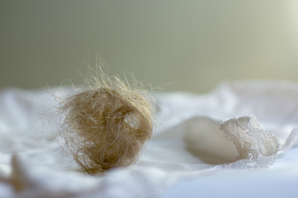 ﻿Postpartum Hair Loss, ﻿2012