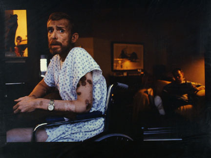 Ken Meeks, Patient With AIDS, Being Cared For By A Friend, San Francisco, California